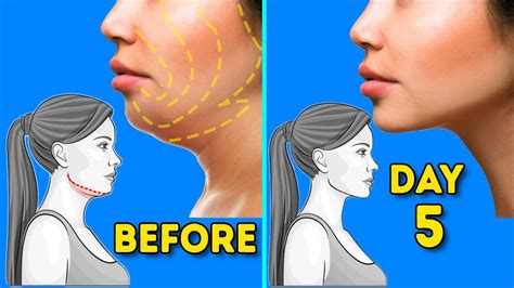 How to lose double chin in 5 days - How to Lose Double Chin in 5 Days? Most people want to see results almost immediately when it comes to losing fat. However, losing chin fat and extra face …